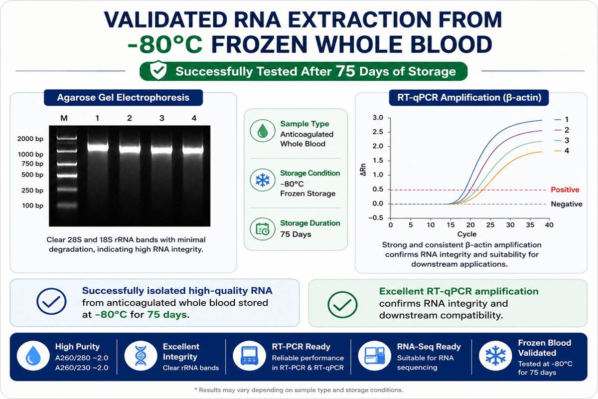 -80°C frozen whole blood RNA extraction gel electrophoresis results -80°C frozen whole blood RNA extraction gel electrophoresis results