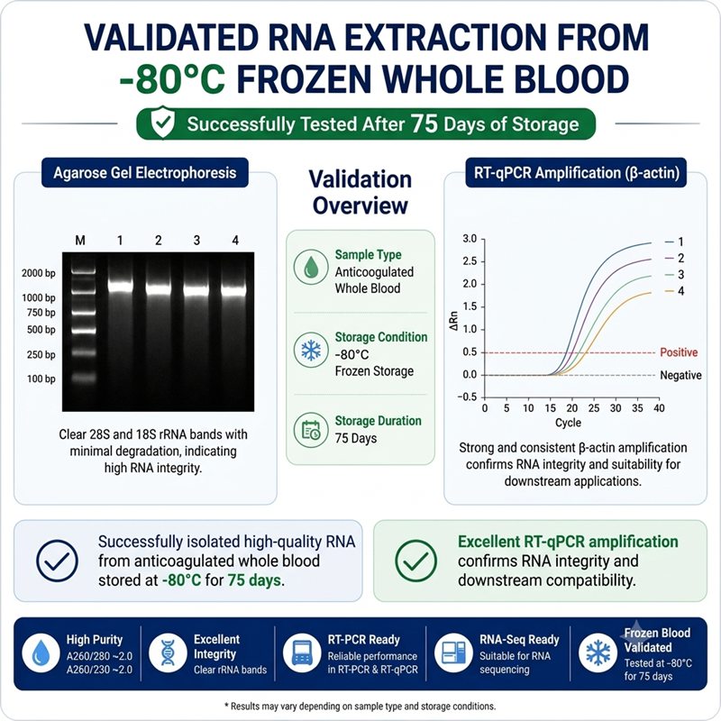 -80°C frozen whole blood RNA extraction gel electrophoresis results -80°C frozen whole blood RNA extraction gel electrophoresis results