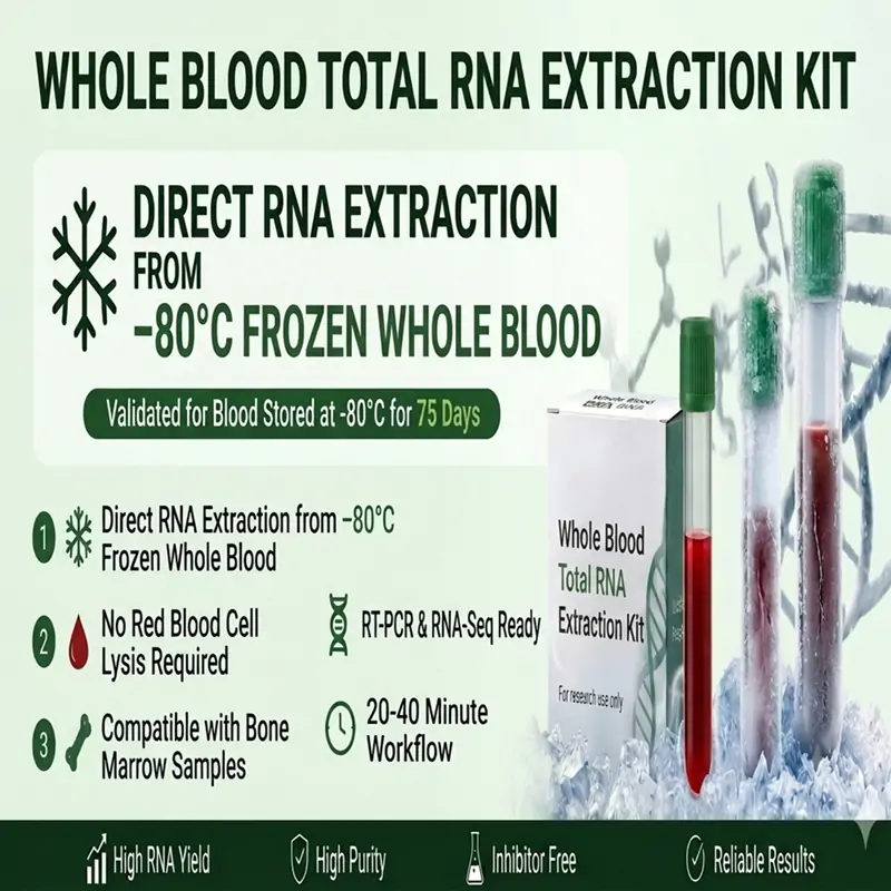 -80°C frozen whole blood RNA extraction gel electrophoresis results -80°C frozen whole blood RNA extraction gel electrophoresis results